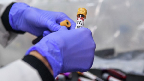 "Инвитро" выявила антитела к COVID-19 почти у каждого шестого россиянина