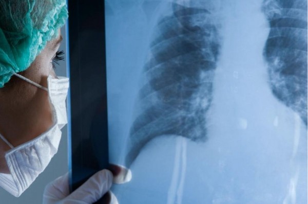 В Башкирии количество выписанных пациентов от пневмонии превысило число новых заражений В Башкирии количество выписанных пациентов от пневмонии превысило число новых заражений