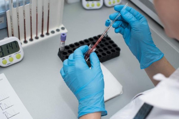 Уфимский врач из ковид-госпиталя: &laquo;От коронавируса не умирают, умирают от его последствий&raquo;